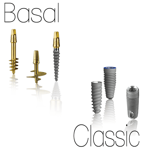 Basal vs Classic