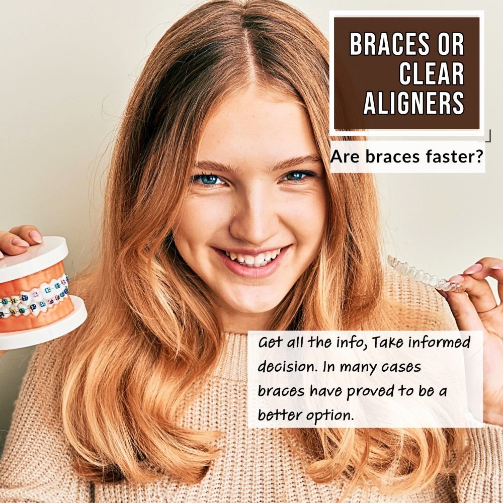 Braces vs Aligners